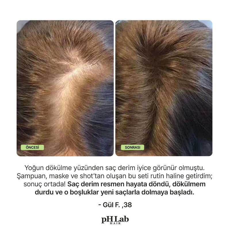 Exosome, NAD+ & Triple PDRN Hair & Scalp Therapy Set