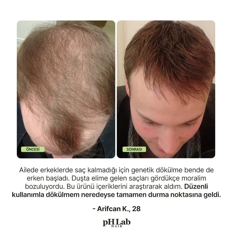 Exosome, NAD+ & Triple PDRN Hair & Scalp Care Şampuan Men - 10