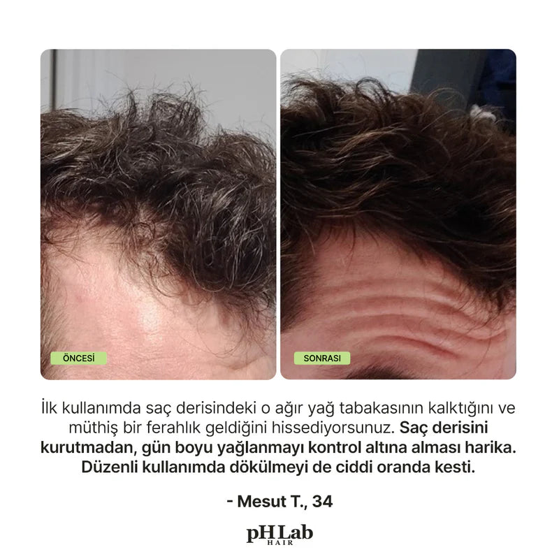 Exosome, NAD+ & Triple PDRN Hair & Scalp Care Şampuan Men - 9