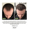 Exosome, NAD+ & Triple PDRN Scalp Shot Men
