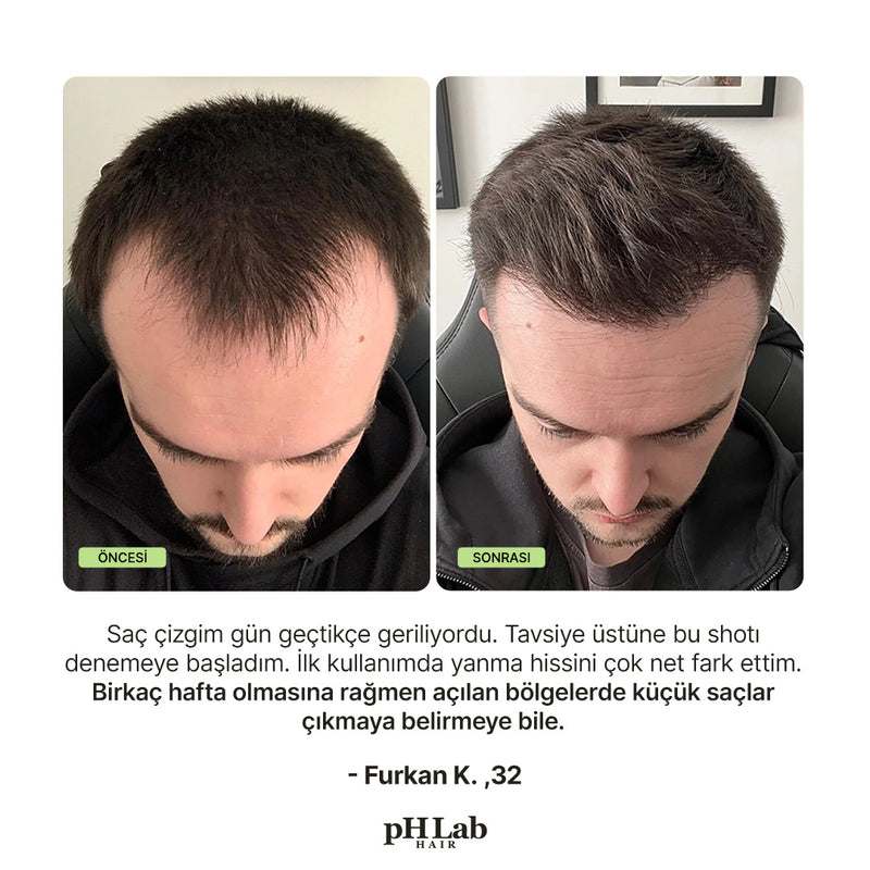 Exosome, NAD+ & Triple PDRN Scalp Shot Men - 12