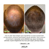 Exosome, NAD+ & Triple PDRN Scalp Shot Men