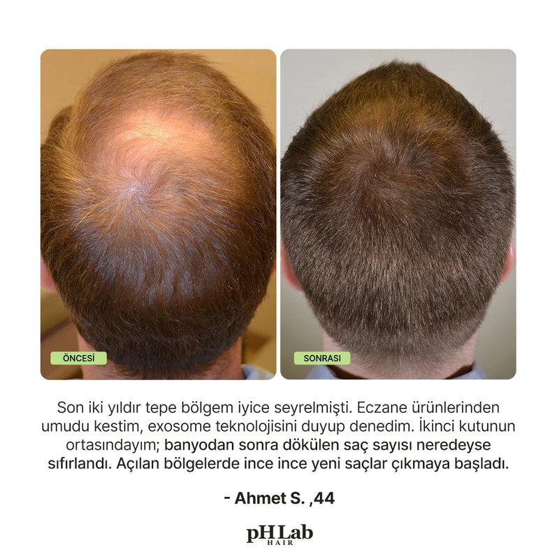 Exosome, NAD+ & Triple PDRN Scalp Shot Men - 11