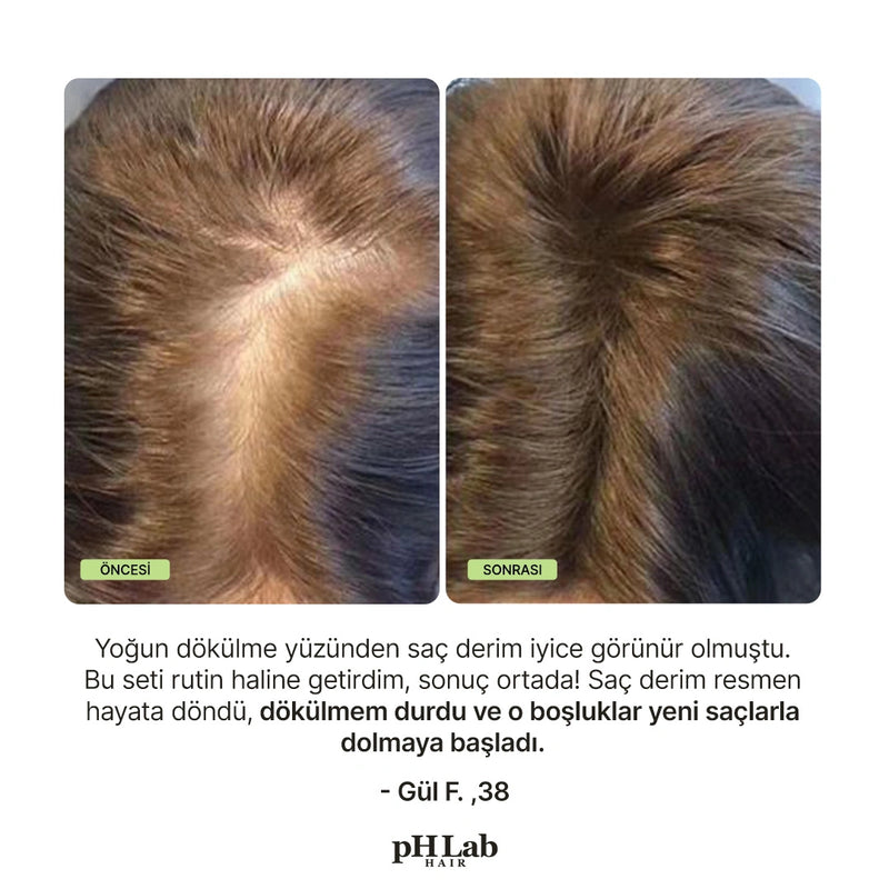 Exosome, NAD+ & Triple PDRN Hair & Scalp Therapy Seti