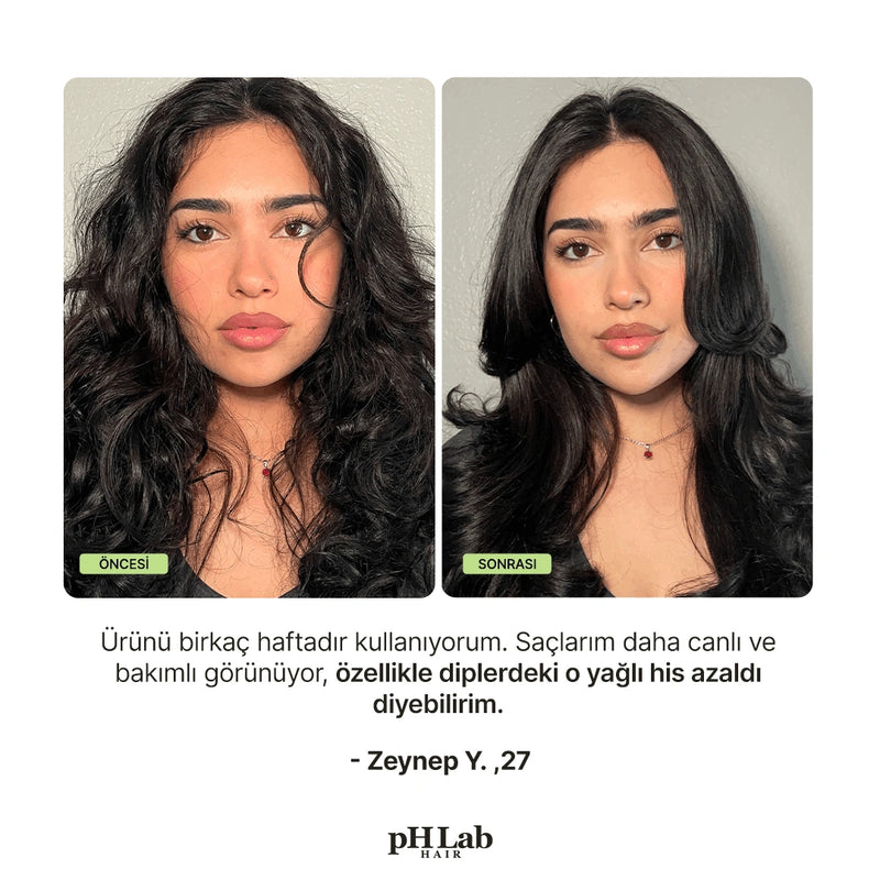 Exosome, NAD+ & Triple PDRN Hair & Scalp Care Şampuan