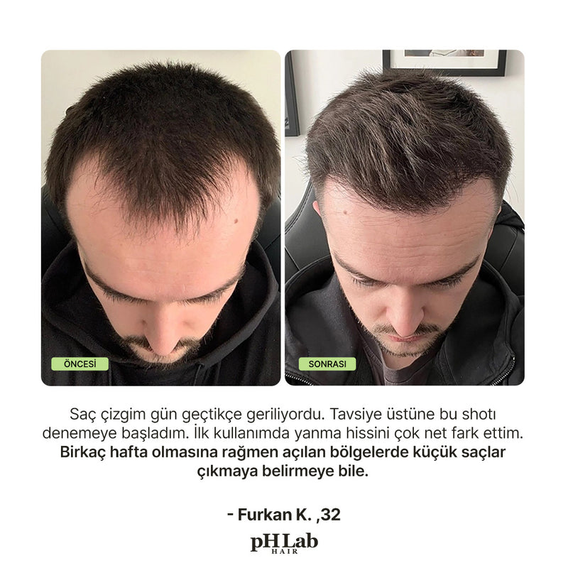Biomimetic Exosome, NAD+ & Triple PDRN Scalp Shot Men